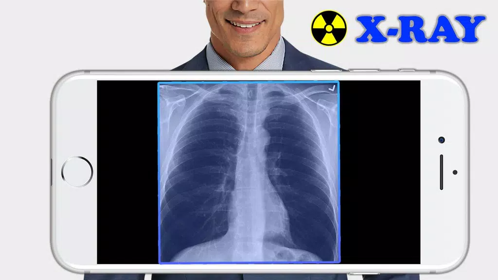 X-Ray Filter Photo Capture d’écran 1