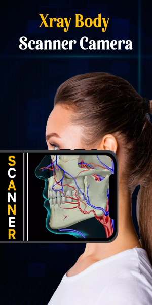 X Ray Mobile v.2.0應用截圖第2張