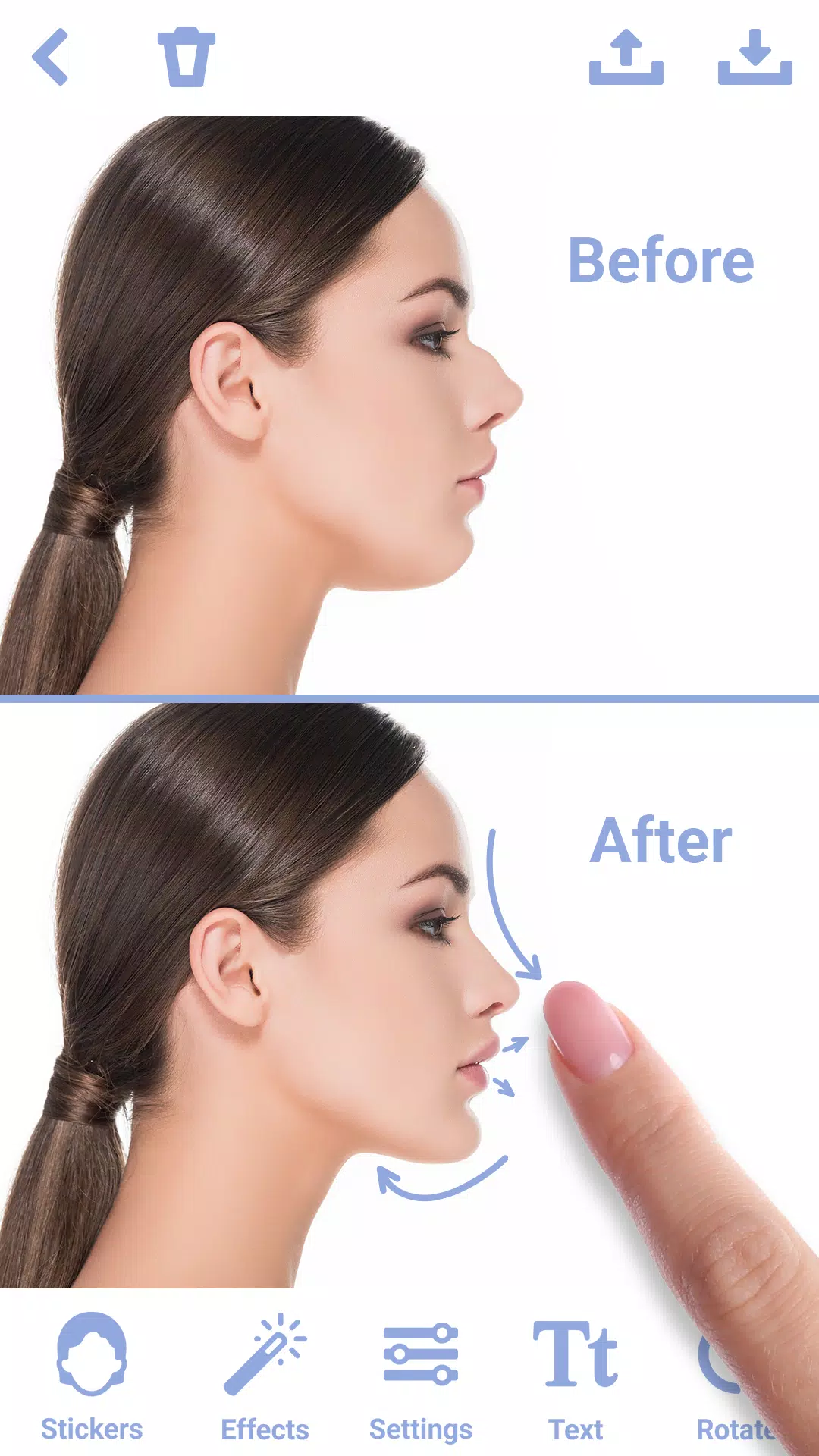 Rhinoplasty スクリーンショット 1