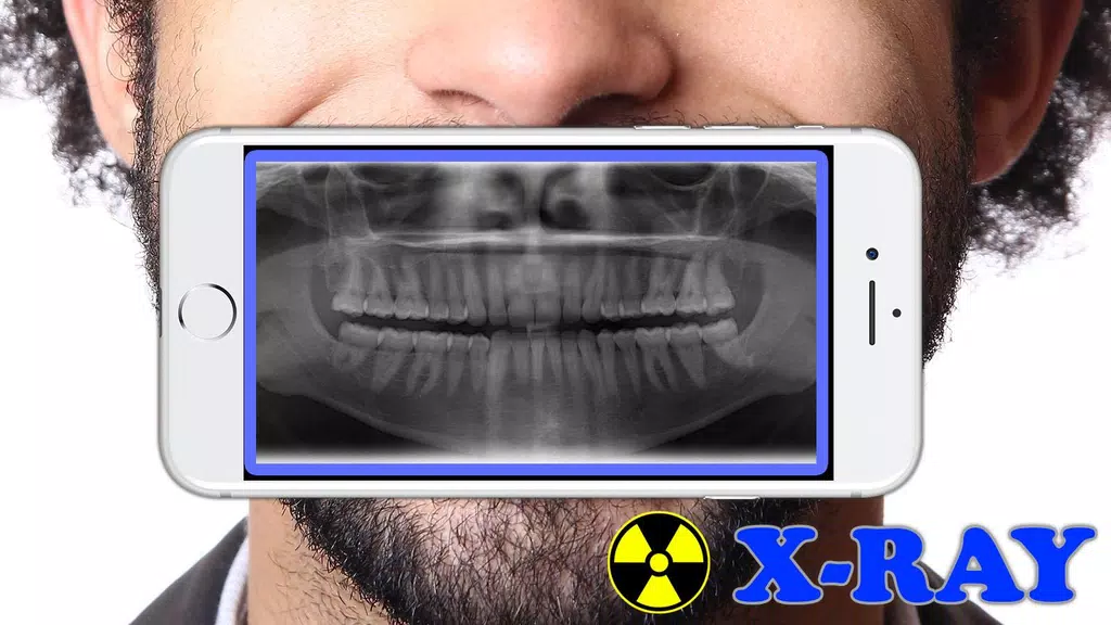 X-Ray Filter Photo Capture d’écran 2