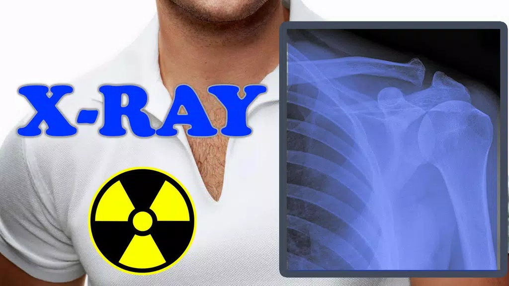 X-Ray Filter Photo Capture d’écran 3